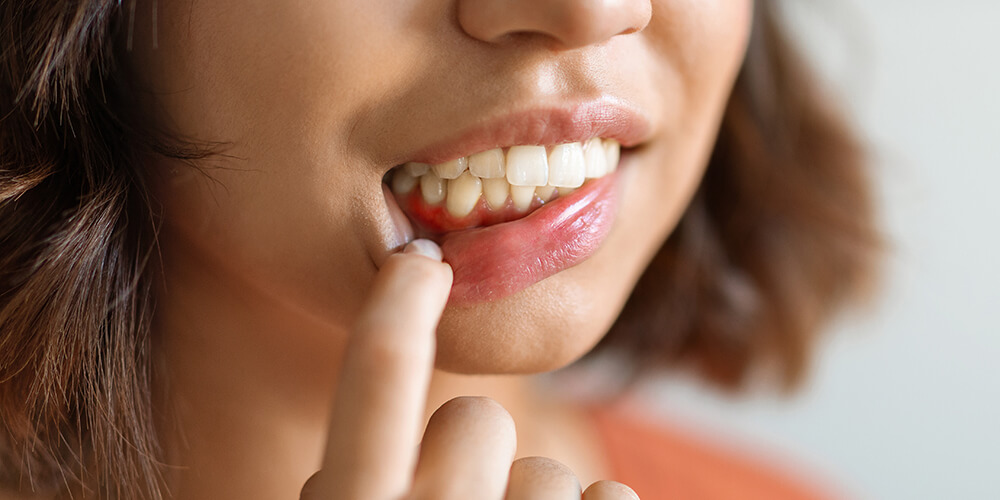 Periodontal Therapy Castle Rock